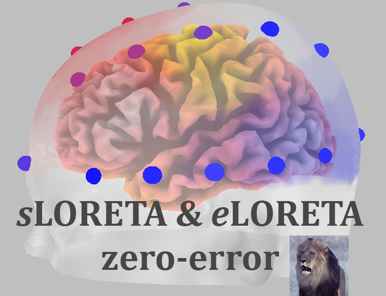 sLORETA